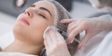 عوارض مزوژل صورت