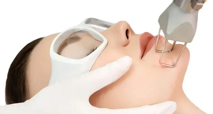 لیزر جوانسازی co2