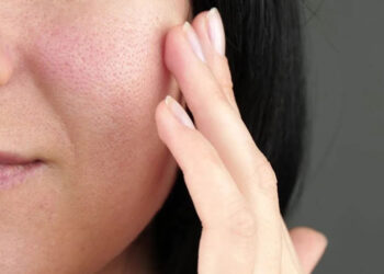 درمان منافذ باز پوست