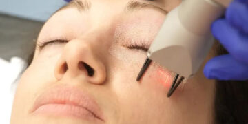 لیزر جوانسازی صورت