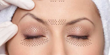 پلاسما درمانی پوست