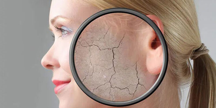 جوانسازی پوست به روش سلول درمانی