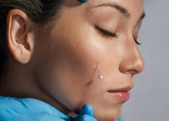 نخ کلاژن ساز صورت