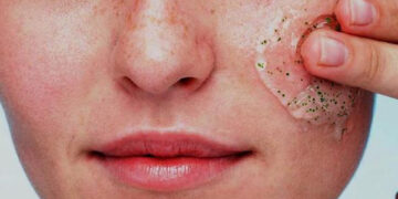 پاکسازی پوست چرب در خانه