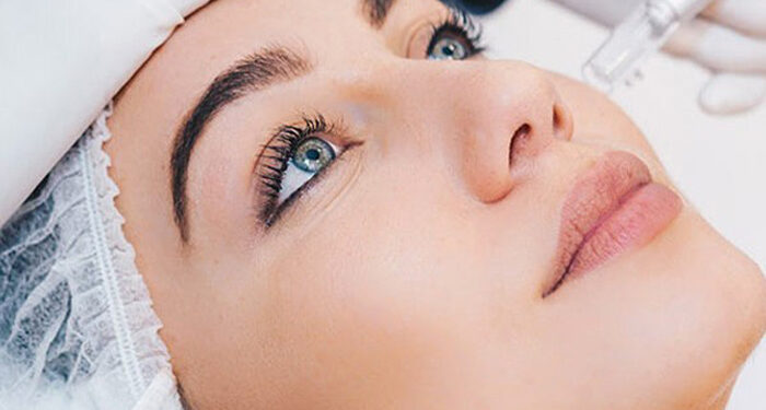 کلاژن ‌سازی پوست با مزوتراپی