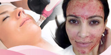 فواید میکرونیدلینگ صورت