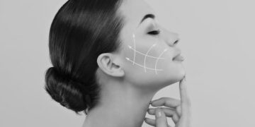 لیفت صورت با نخ کاگ