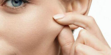 روش های موثر برای سفتی پوست صورت