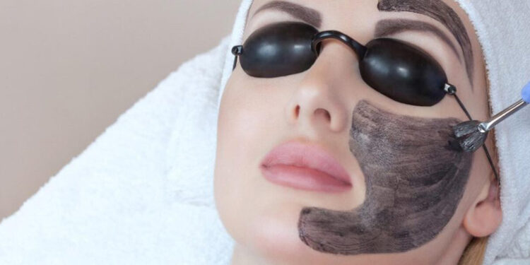 کربن تراپی برای لک صورت