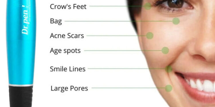 بهترین دستگاه خانگی پاکسازی پوست درماپن A۱