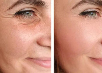 بهترین و سریعترین روش برای جوانسازی و سفتی پوست