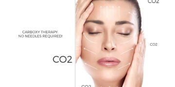 کربوکسی تراپی صورت