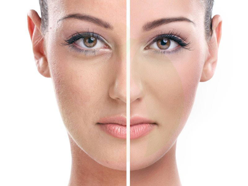 جوانسازی پوست صورت