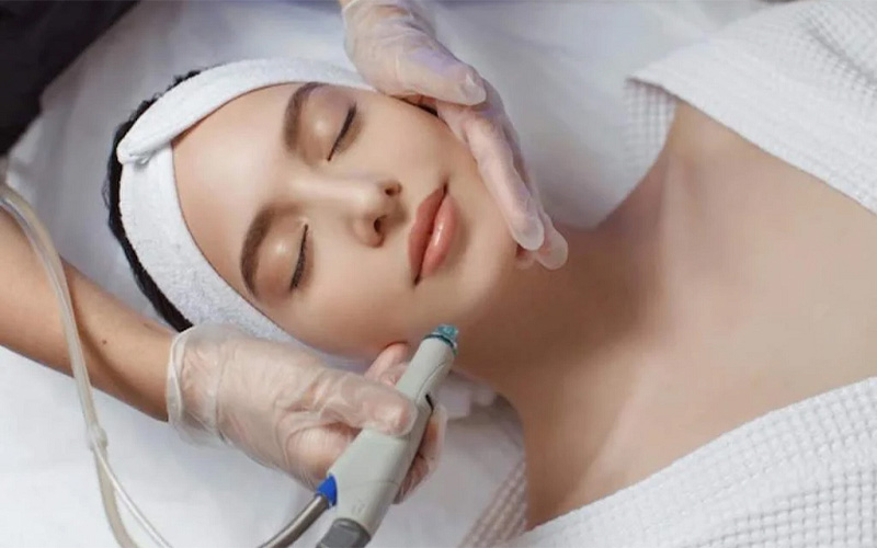 لیزر جوانسازی صورت