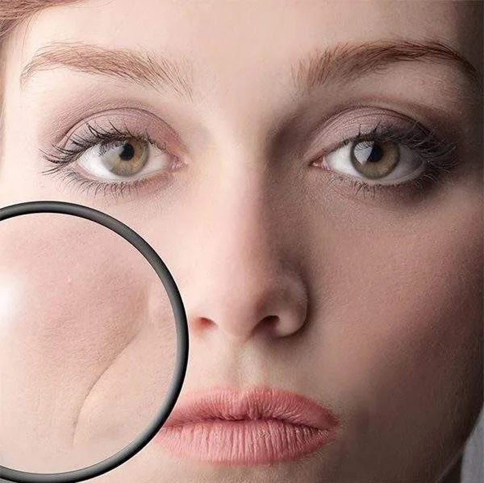 درمان قطعی چین و چروک صورت