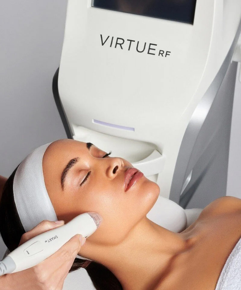 جوانسازی صورت با آر اف ویرچو