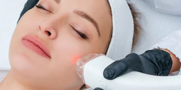بهترین لیزر جوانسازی صورت