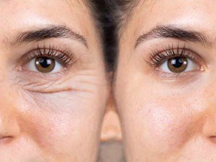 بهترین دستگاه جوانسازی صورت